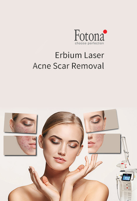 Erbium Lazer Uygulama Erbium Lazer Uygulama