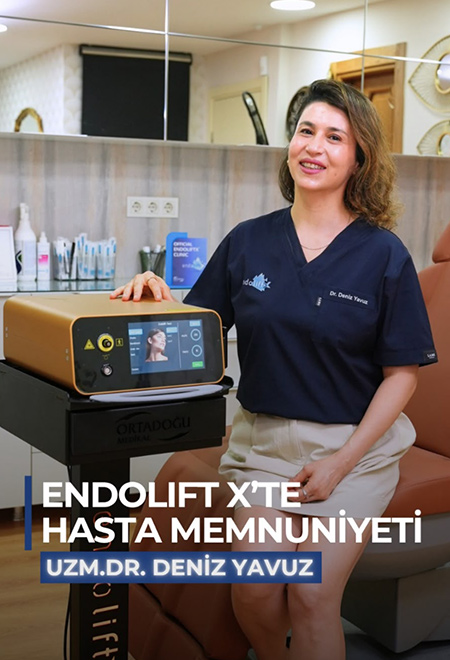 endolift-x